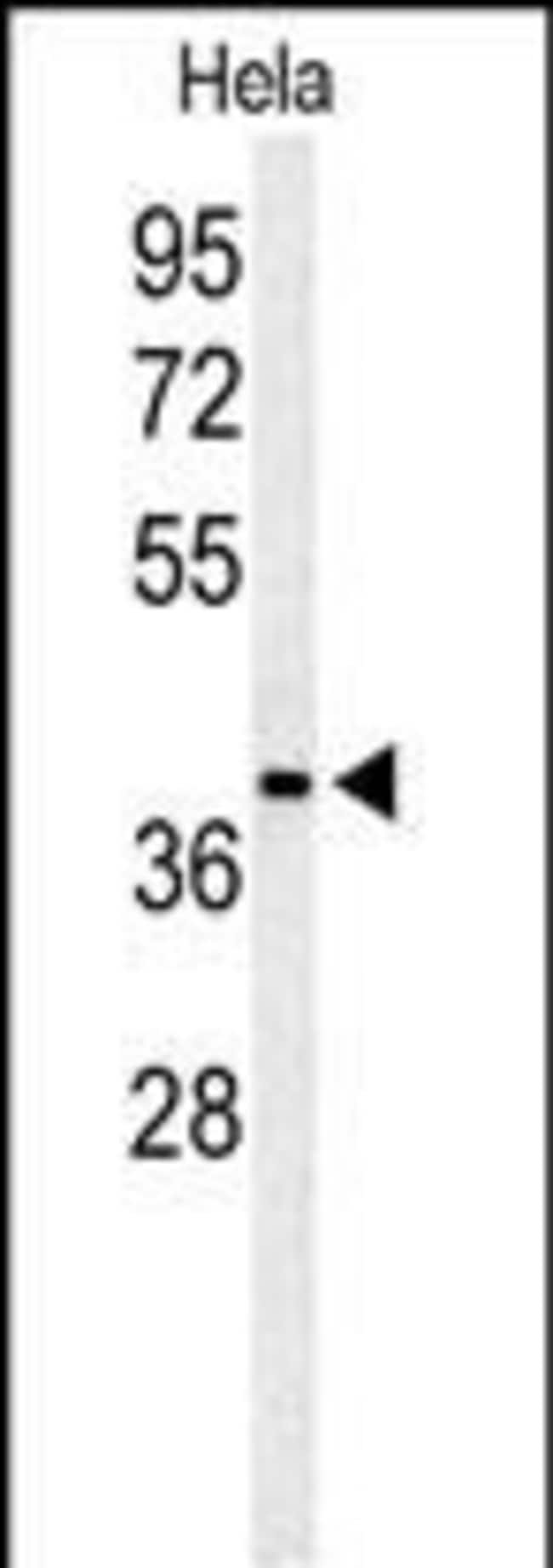 ADPRHL2 Polyclonal Antibody, 100 µg