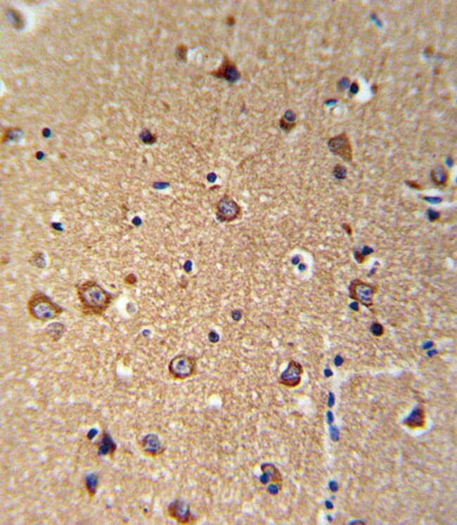 ANKH Polyclonal Antibody, 100 µg