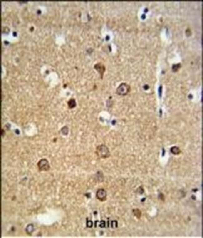 ADAM19 Polyclonal Antibody, 100 µg