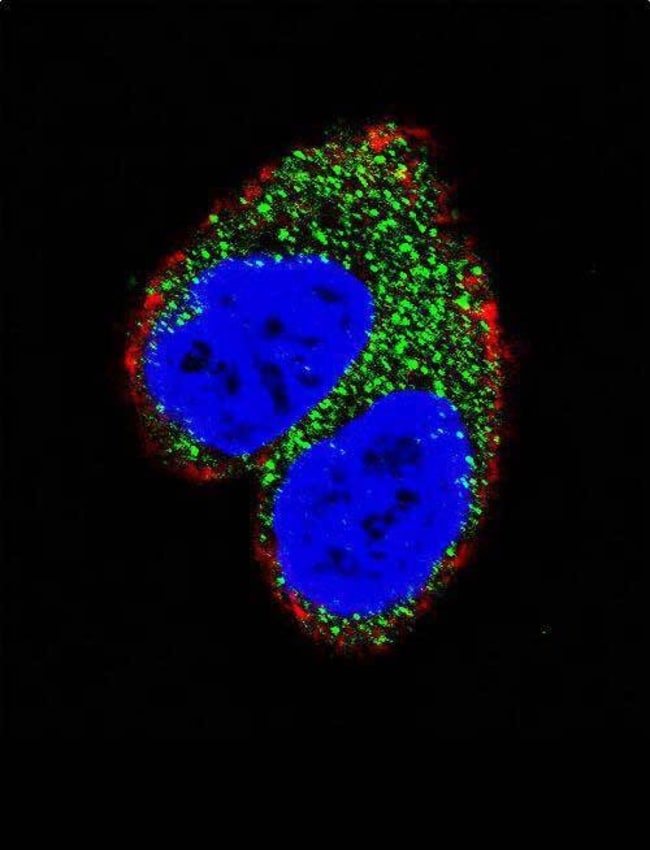AIM2 Polyclonal Antibody, 100 µg