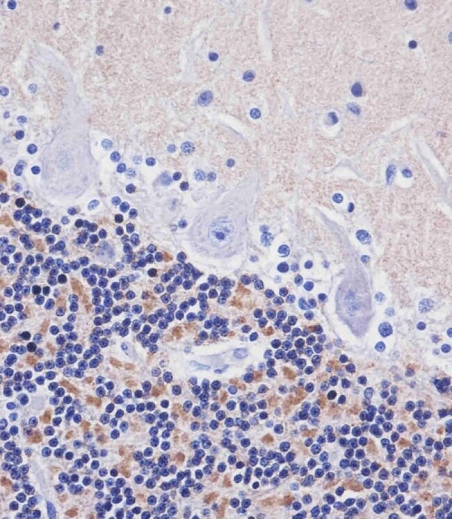 AMH Polyclonal Antibody, 100 µg