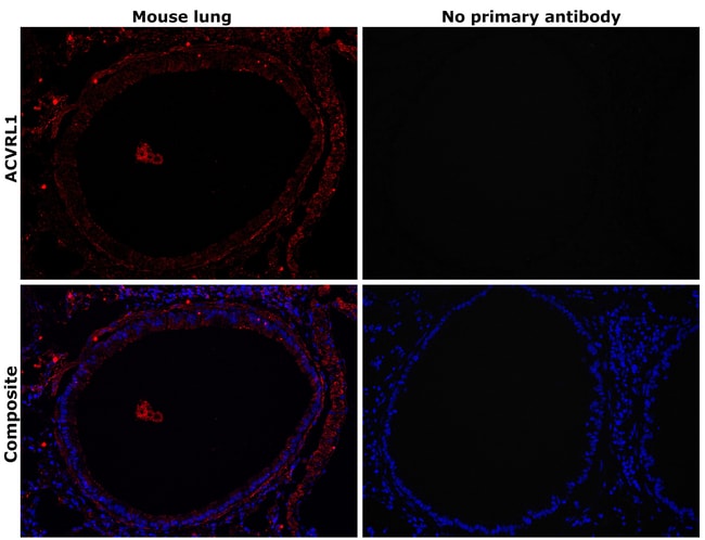 ANTI-ACTIVIN A RECEPTOR TYPE II-LIKE 1