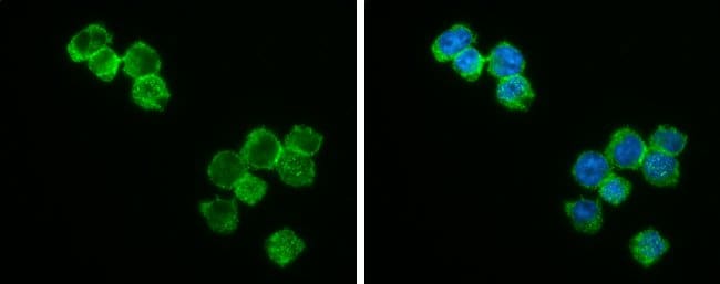100ul BCL2 Polyclonal Antibody for Weste