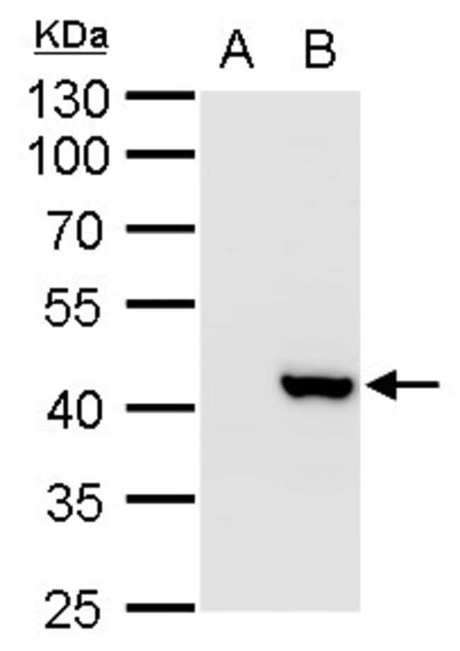 Anti-XRCC3
