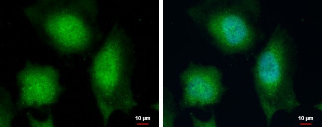 Anti-Calcipressin 1