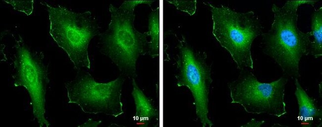 Anti-Cortactin