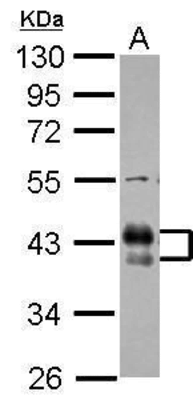 Anti-CD32B
