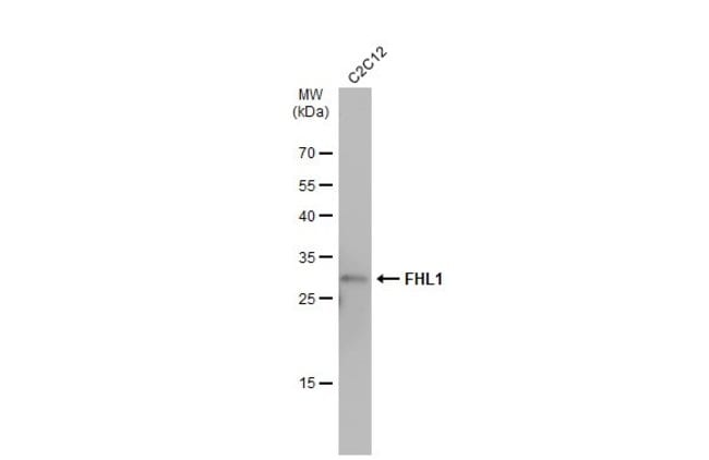 Anti-FHL1