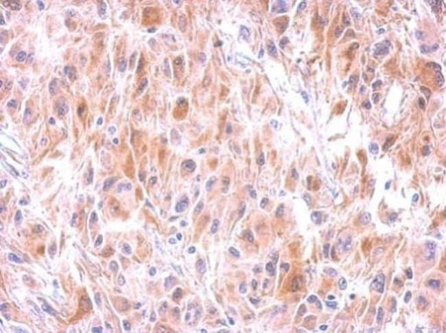 ANTI-GLUTATHIONE S-TRANSFERASE MU 1