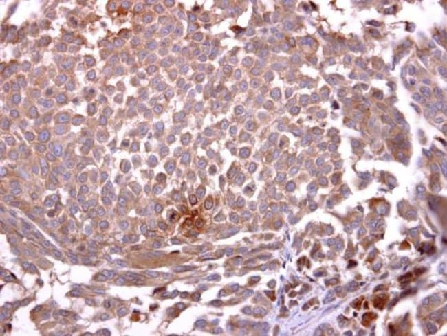 Anti-Glycophorin A