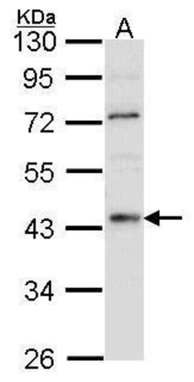 Anti-HNF4 alpha/TCF