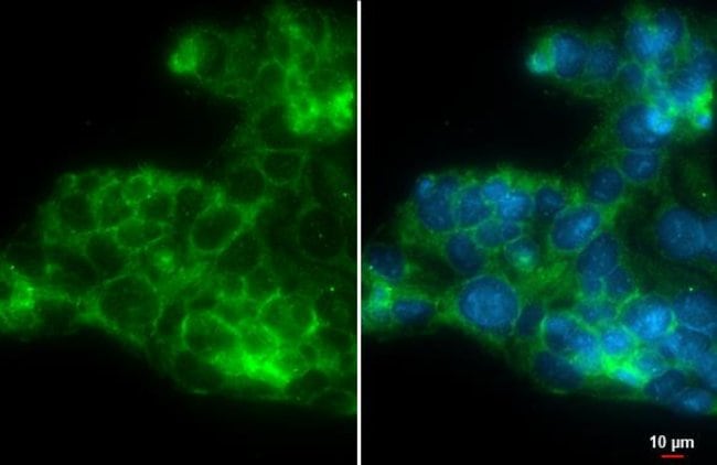 Anti-CXCR5