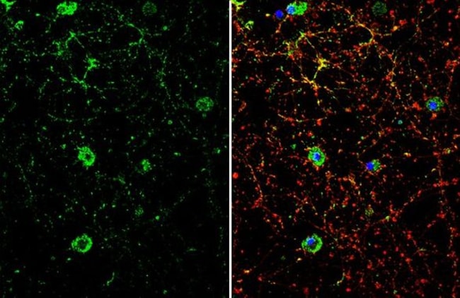 Anti-Dopamine Receptor D1
