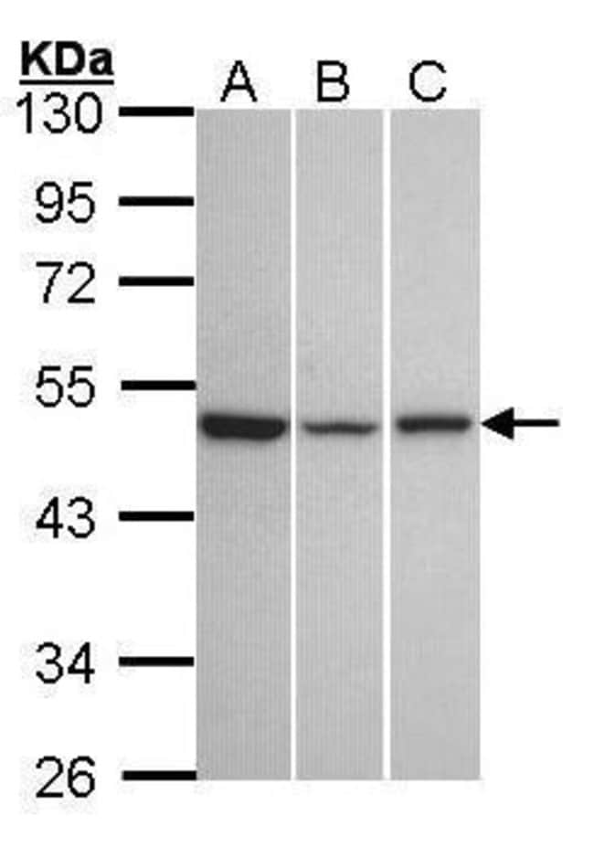 Anti-GPR54
