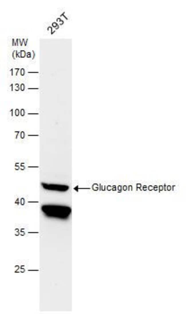 Anti-Glucagon Receptor