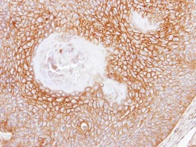 Anti-CD105