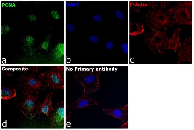 Anti-PCNA