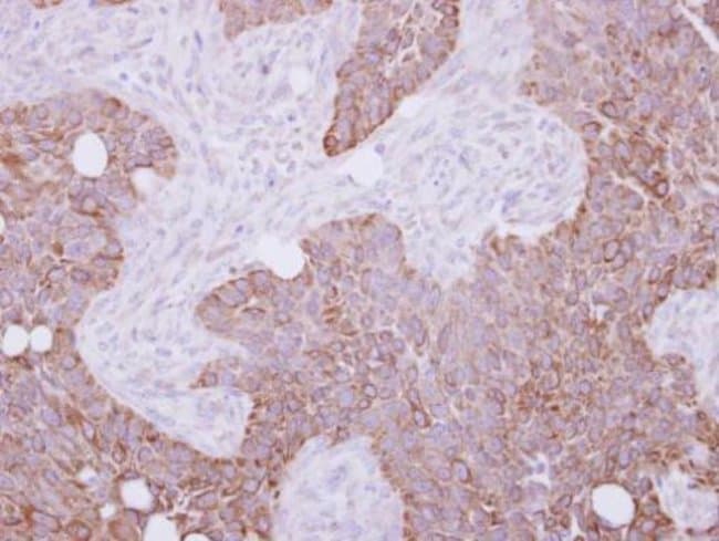 Anti-Cytokeratin 15