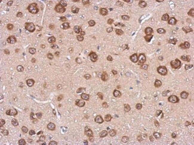 Anti-cystatin F