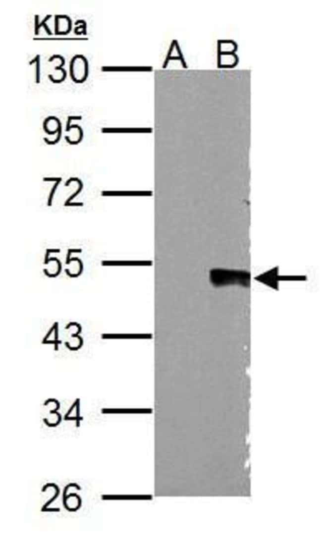 Anti-WNT5A