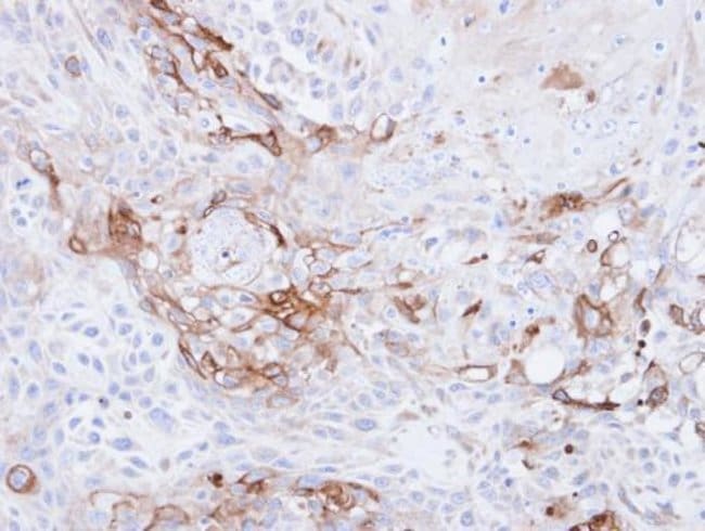 Anti-CD36