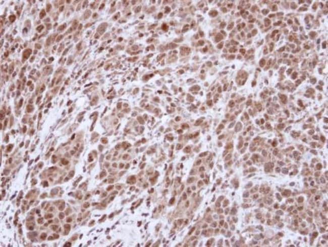 Anti-Topoisomerase II alpha