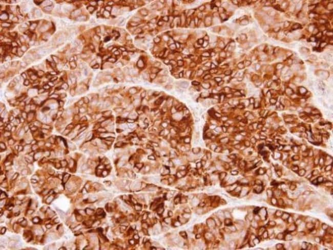Anti-Cystatin S