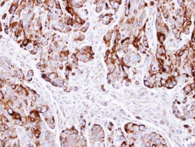 Anti-Cytokeratin 20