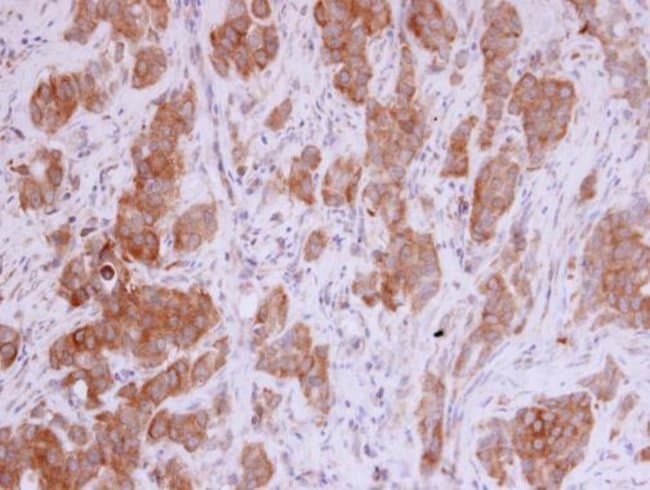 Anti-MMP12
