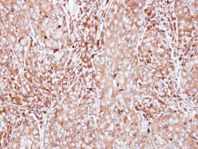 Anti-MMP3