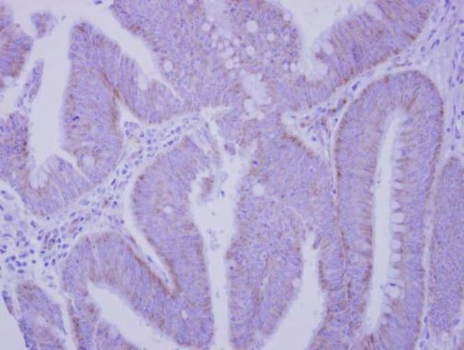 Anti-Integrin alpha V