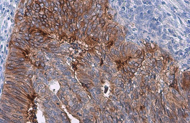 Anti-Tissue factor