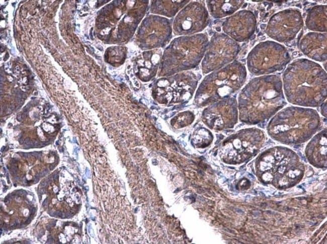 Anti-RPSA