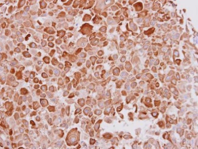 Anti-Cytokeratin 16