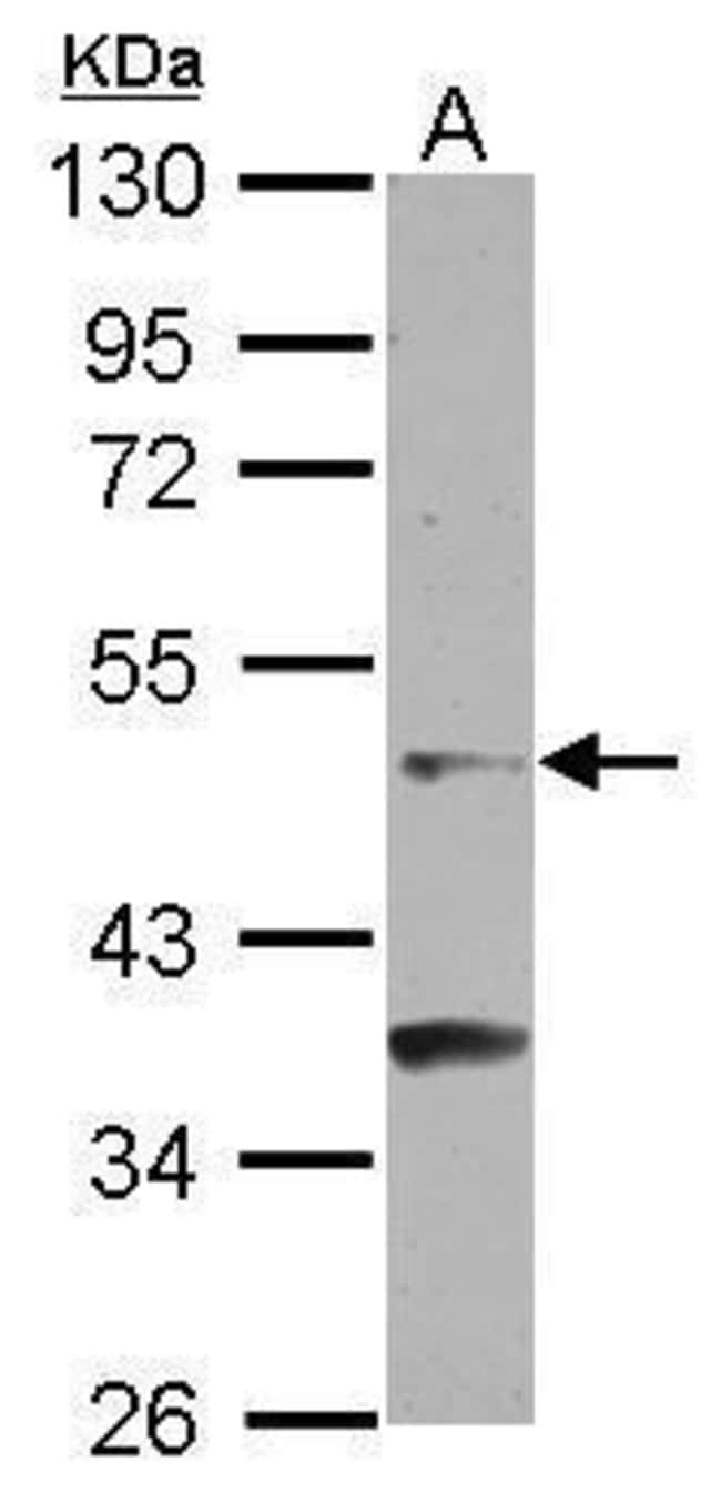 Anti-GCNF