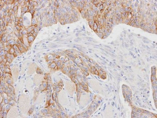 Anti-CD147