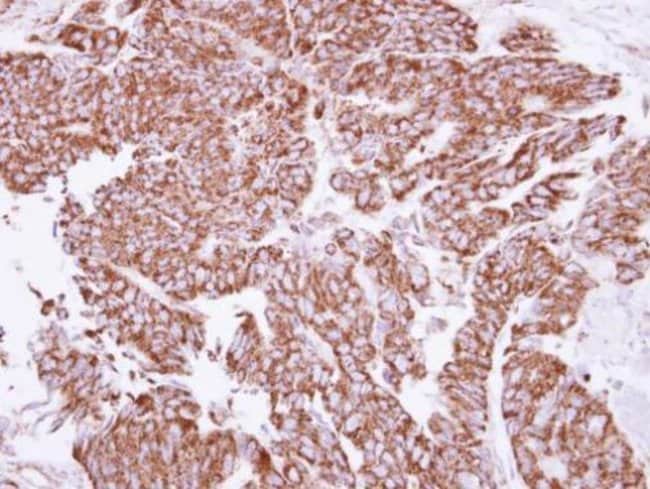 ANTI-ANGIOPOIETIN 2