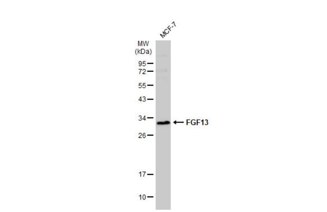 Anti-FGF13