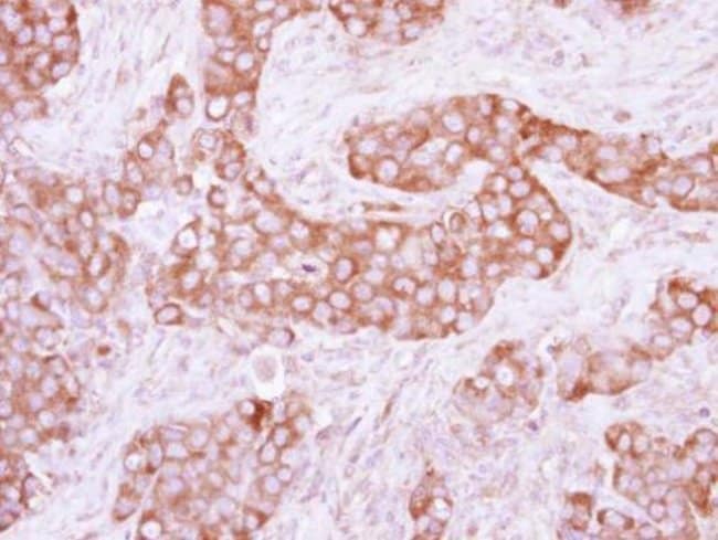 ANTI-PYRUVATE KINASE (LIVER/RBC)