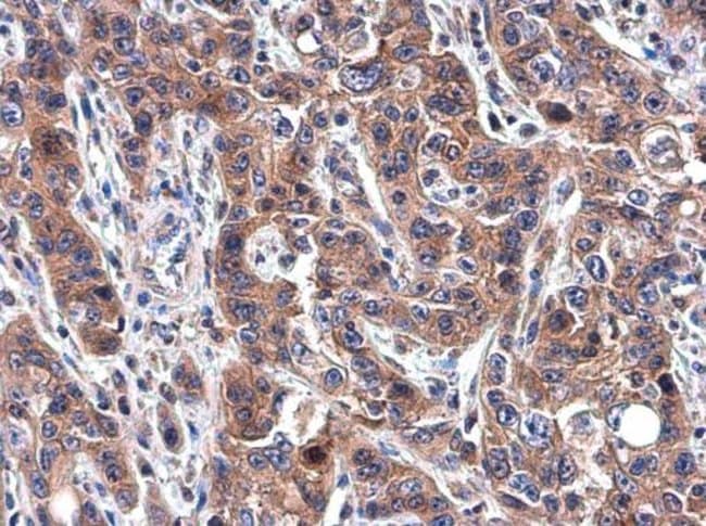 Anti-Transferrin