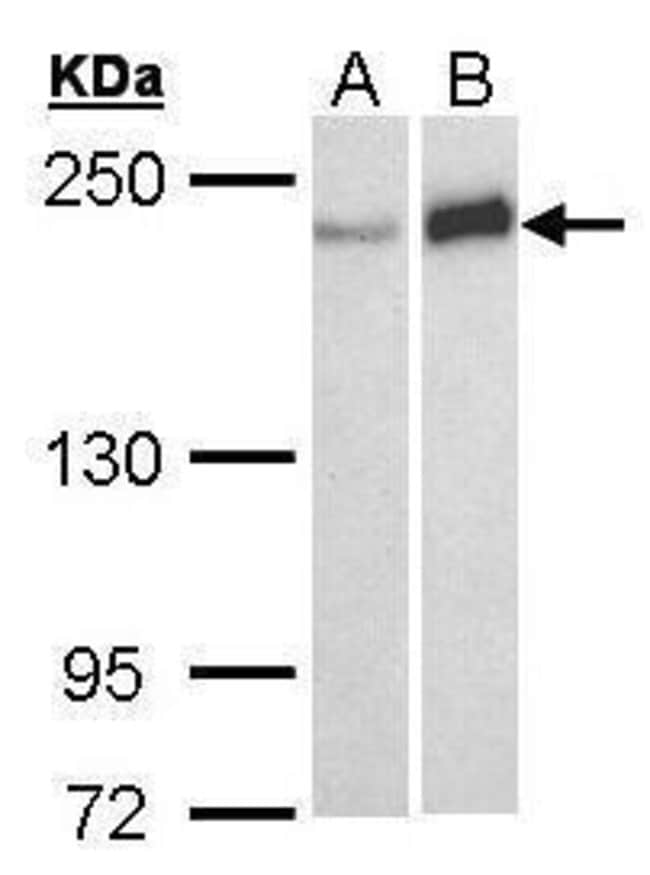 Anti-Werner syndrome protein