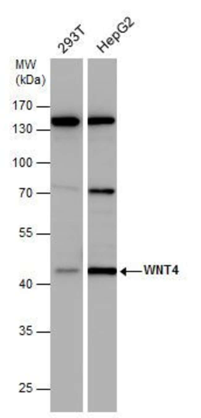 Anti-WNT4