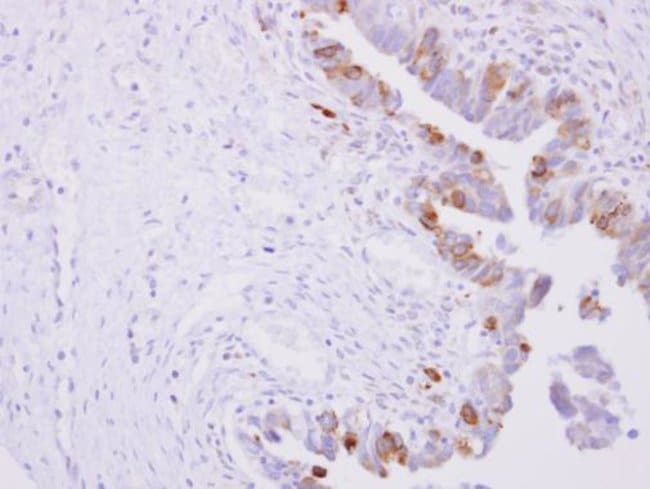 ANTI-CYTOCHROME P450 REDUCTASE