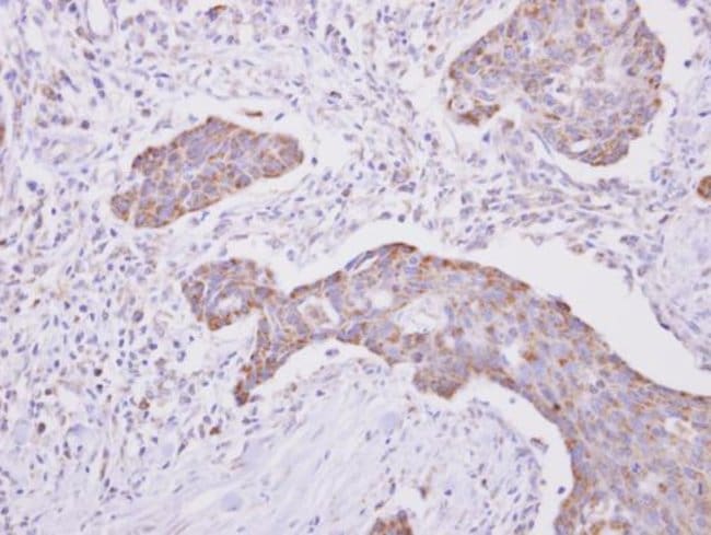 ANTI-CYTOCHROME P450 REDUCTASE