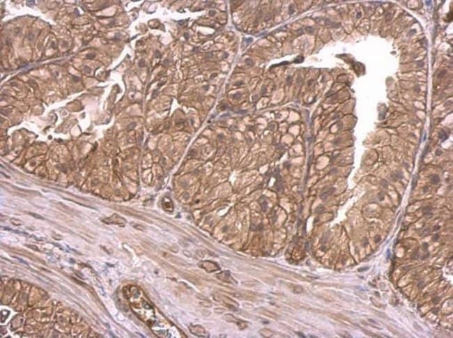 Anti-Insulin Receptor