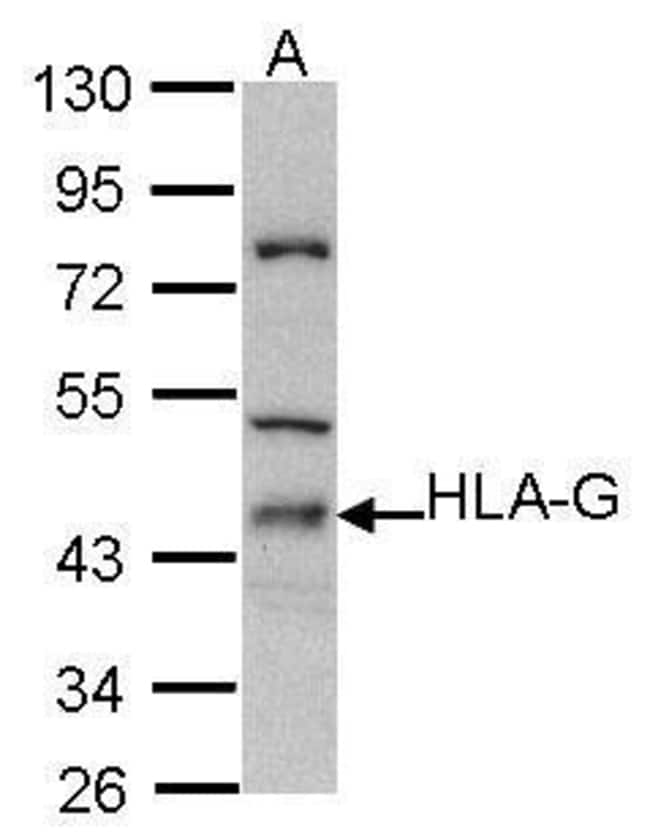 Anti-HLA-G