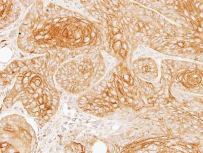 Anti-Galactosidase alpha