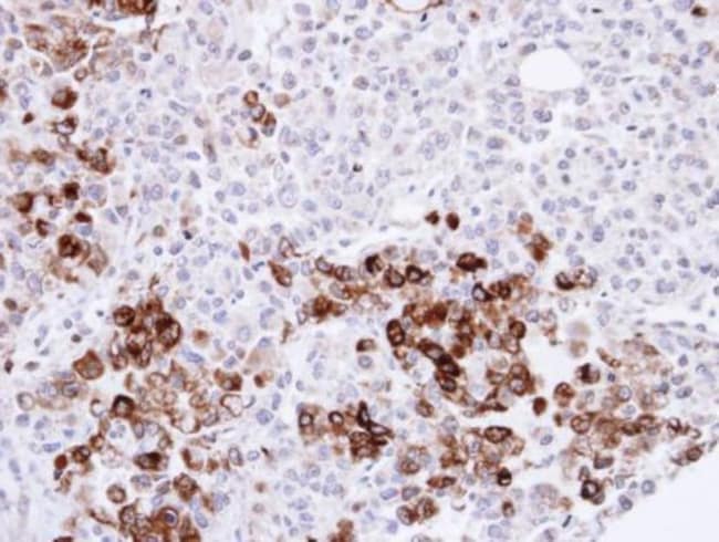 Anti-Gelsolin