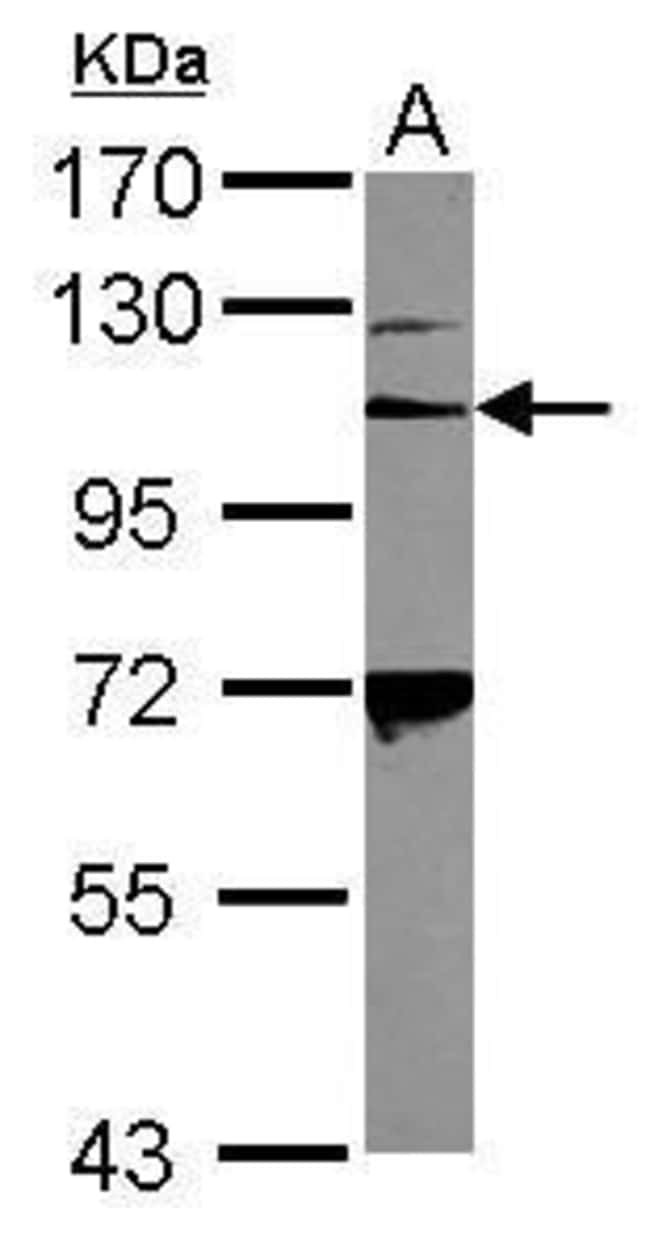 Anti-Integrin alpha 2b
