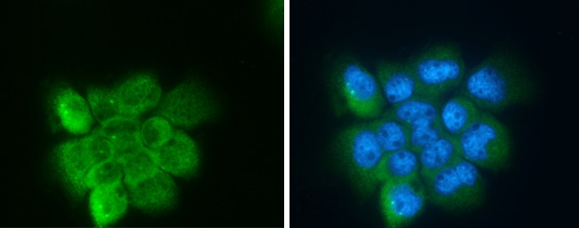 Anti-Apolipoprotein D